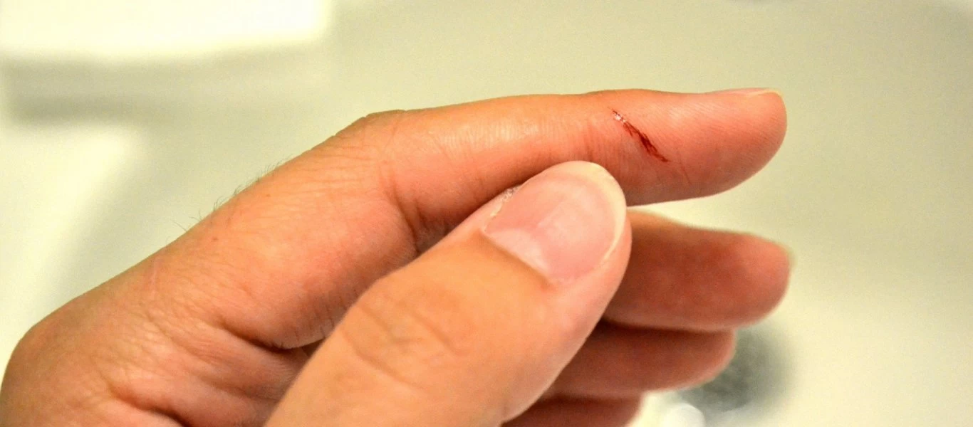 Κόψατε το δάκτυλό σας με το μαχαίρι; - Βάλτε αυτό και θα «σωθείτε»